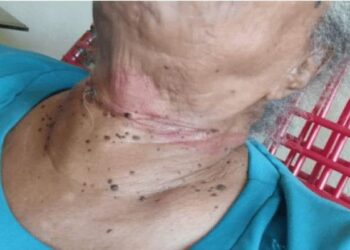 Menores pedem água a idosa, a roubam e enforcam com coleira, em Goiás