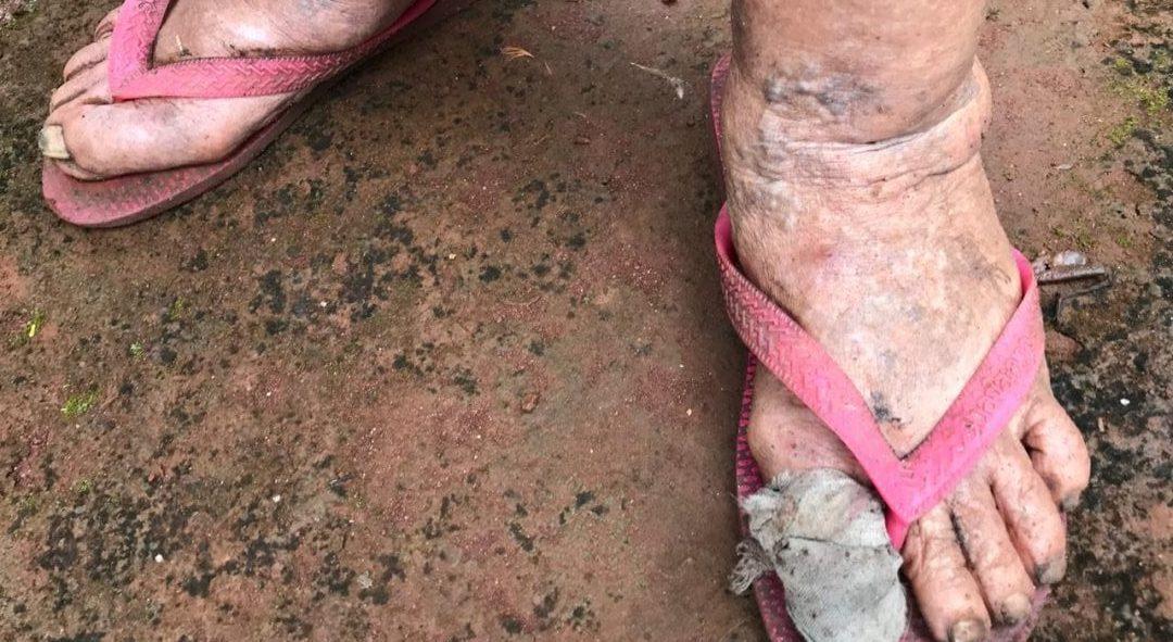 Idosas de 70 e 80 anos, vítimas de maus-tratos, são resgatadas em Anápolis