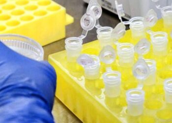 Goiás compra 300 mil testes rápidos de coronavírus