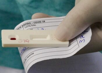 Aplicação de testes rápidos em farmácias de Goiás preocupa Sindilabs