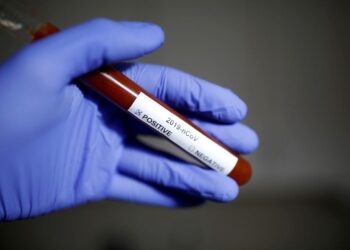 Coronavírus em Goiás: sobe para 115 casos confirmados e 3 óbitos