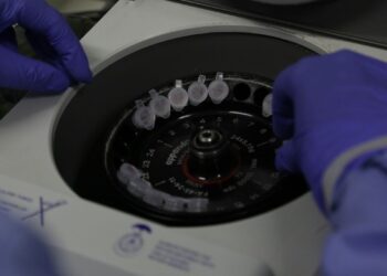 Goiânia soma quase 400 casos confirmados de coronavírus