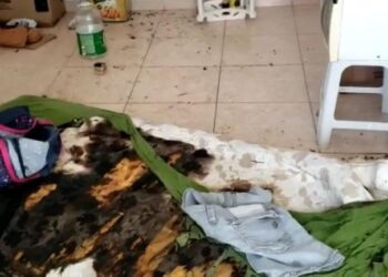 Mulher tem corpo queimado pela companheira, em Goiânia
