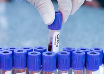Goiás investiga mais de 21 mil casos suspeitos de covid-19