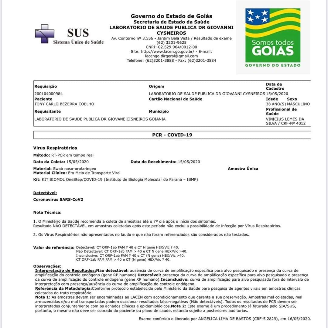 Negativo para coronavírus, Caiado divulga teste positivo de assessor 