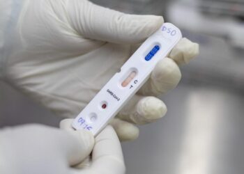 Lei dá prioridade a profissionais essenciais na realização de testes de covid-19