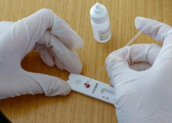 Saiba como funcionam os testes para detectar a covid-19
