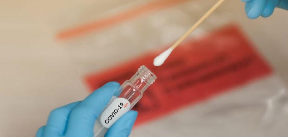 Covid-19: Goiás chega a 2.475 óbitos confirmados