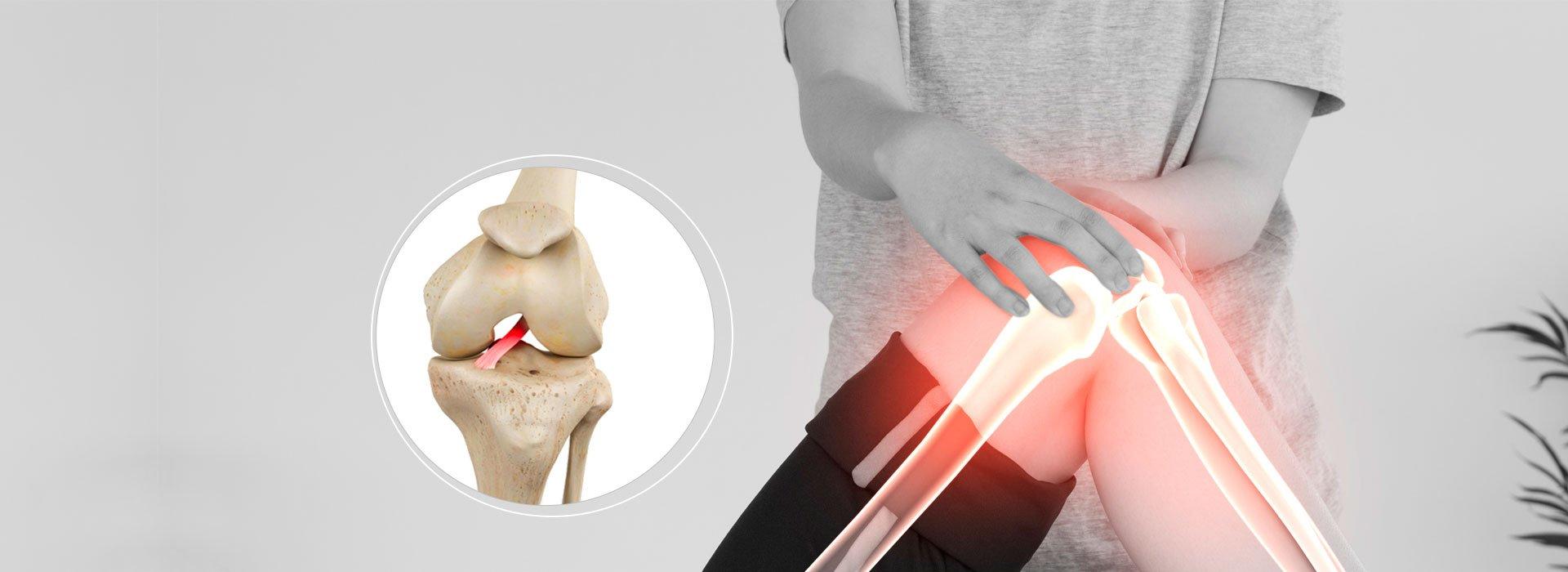 Lesão do Ligamento Cruzado Anterior especialista de joelho