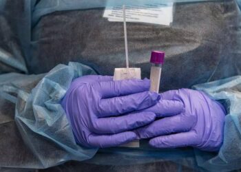 Posse confirma novo caso de flurona, dupla infecção por Covid-19 e Influenza