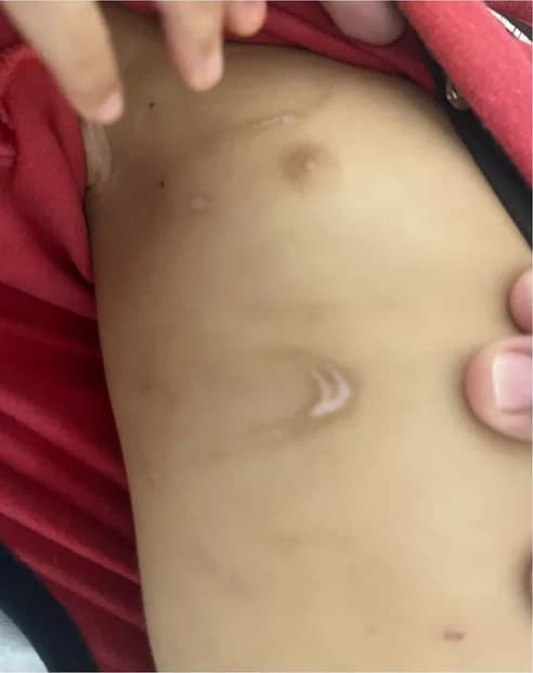 Tia é indiciada suspeita de torturar sobrinho de 1 ano, em Goianira
