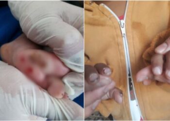 Menino de 2 anos é encontrado com vários machucados, em Planaltina; pais são indiciados