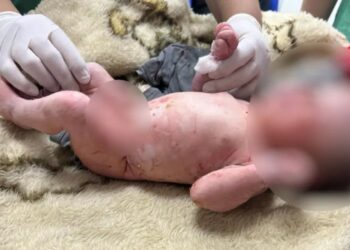 Mulher que disse ter achado bebê em saco de lixo, em Itapuranga, é a mãe da criança
