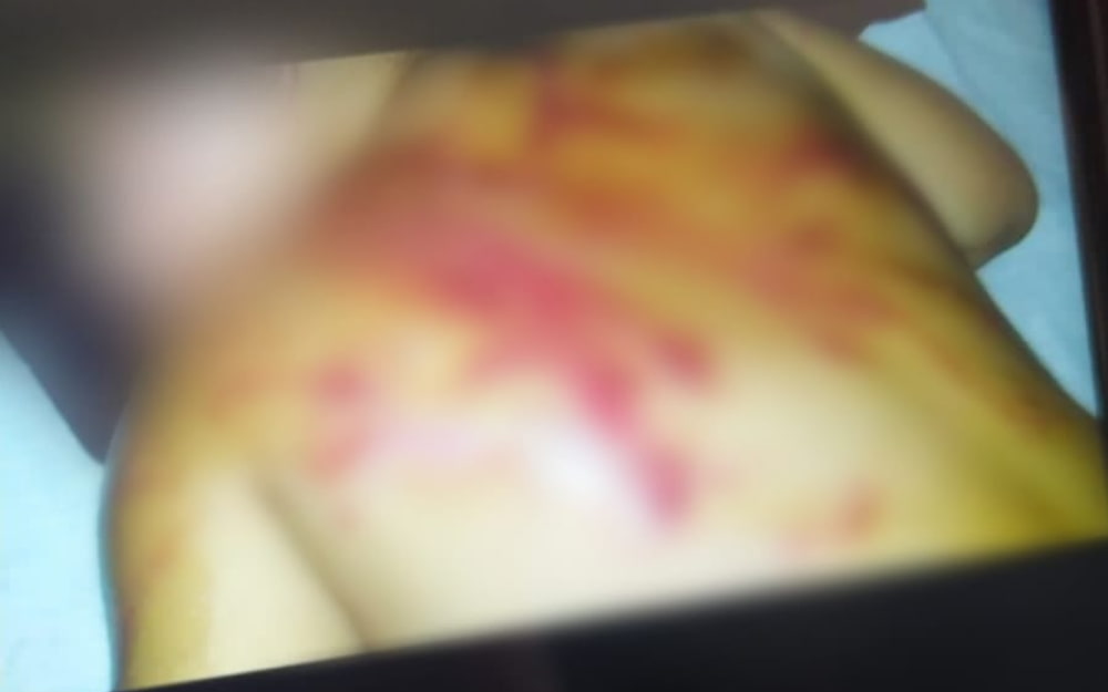 Menina de 8 anos é torturada pela mãe após 'mau comportamento', em Trindade