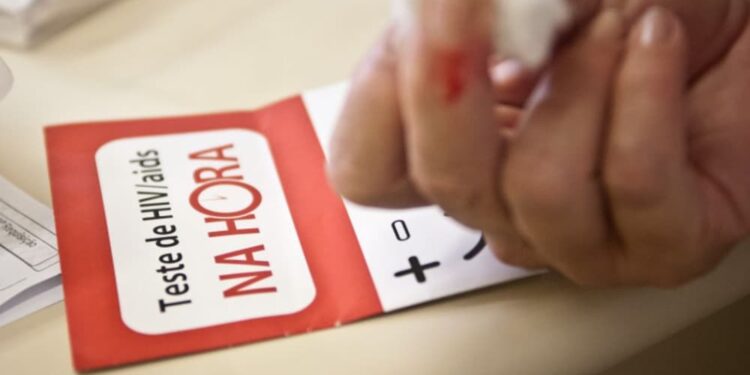 Sobe o número de casos de aids entre jovens de 15 a 29 anos, alerta MS
