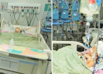 Gêmea siamesa volta a ter crise convulsiva e está em coma induzido, em Goiânia