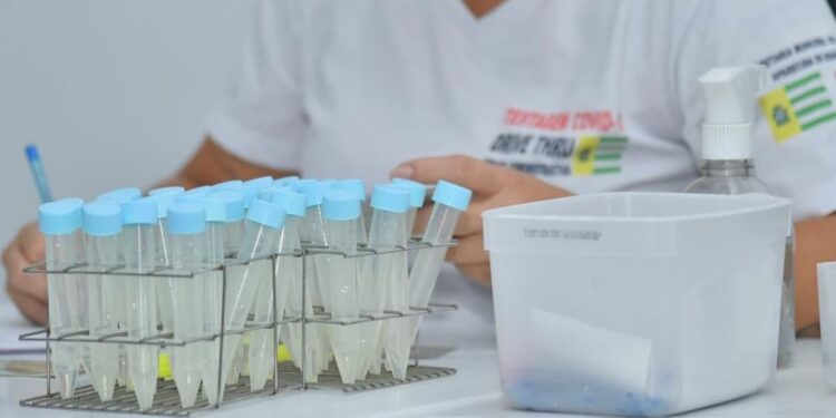 Aparecida identifica nova subvariante do coronavírus com alta transmissibilidade; Brasil soma 7 casos