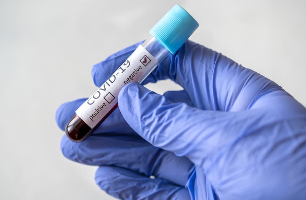 OMS declara fim da pandemia de covid-19
