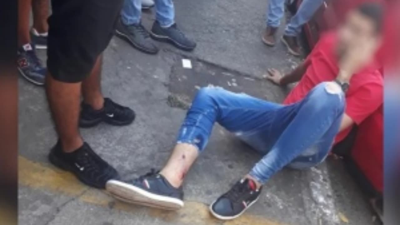 homem baleado na região da 44