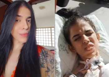 Jovem que passou mal após cheirar pimenta segue na UTI sem previsão de alta