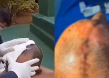 Turista tem corte profundo