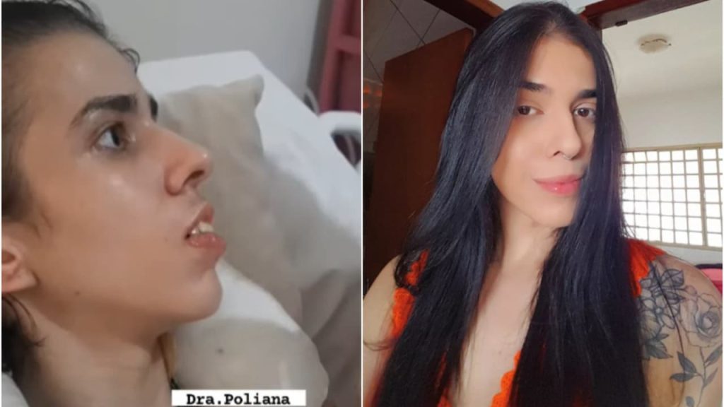 Jovem que passou mal após cheirar pimenta responde a estímulos durante tratamento em casa