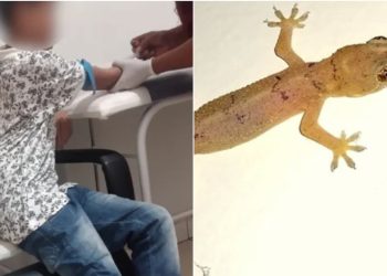 Internado pela 3ª vez, menino que comeu lagartixa frita já perdeu 3kg, diz mãe 