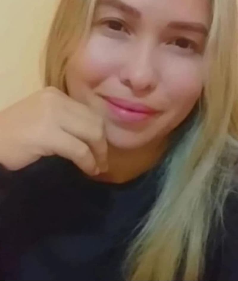Mulher que teve rosto desfigurado