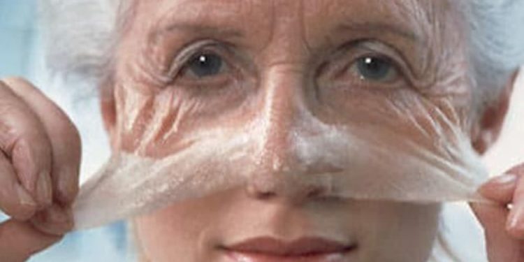 Pesquisa revela os melhores especialistas em peeling de fenol no Brasil