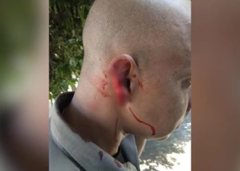 Homem arranca parte da orelha de policial durante abordagem em Goiás