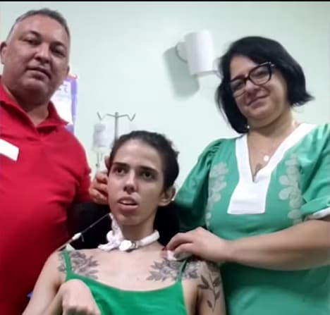 Jovem que cheirou pimenta 