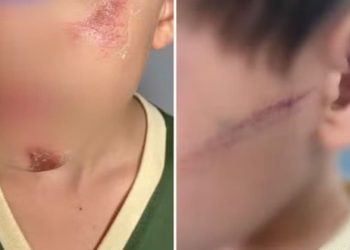 Mãe e madrasta são suspeitas de bater em irmãos com faca, em Goiás