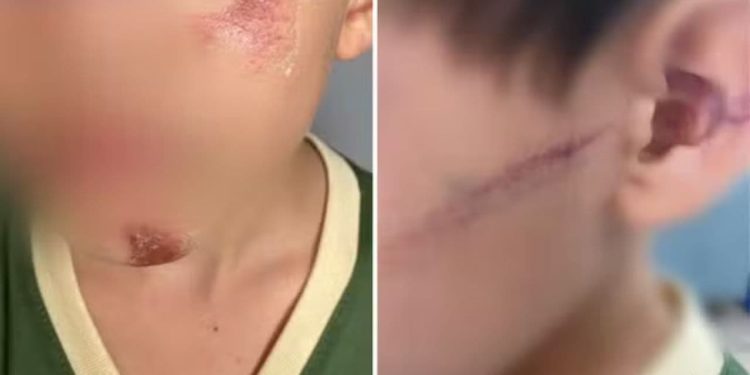 Mãe e madrasta são suspeitas de bater em irmãos com faca, em Goiás