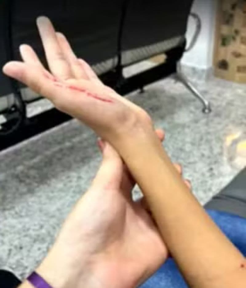 Pitbull ataca crianças em escolas