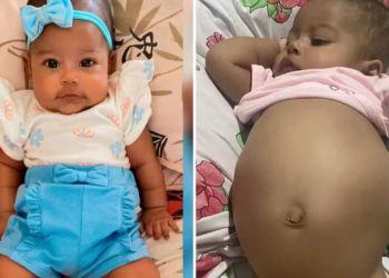 Bebê de 4 meses com suspeita de tumor na barriga luta por tratamento no SUS, em Goiás