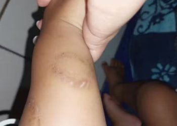 Mãe e padrasto são presos suspeitos de torturar bebê de 1 ano, em Goiás