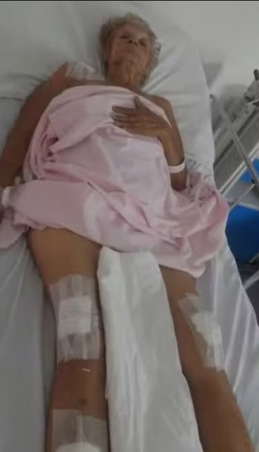 idosa atropelada em Goiânia