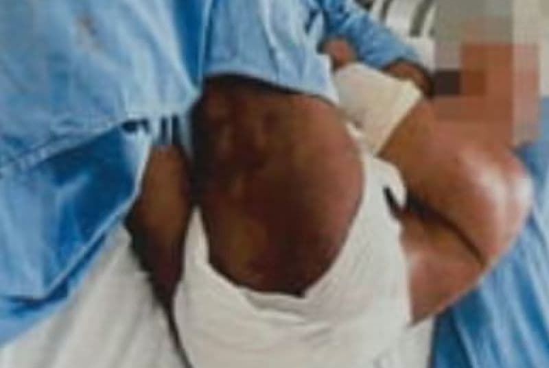 Suspeito de tortura