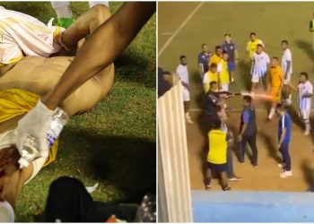 Goleiro baleado por PM disse que pediu para que ele abaixasse a arma: "Psicológico abalado"