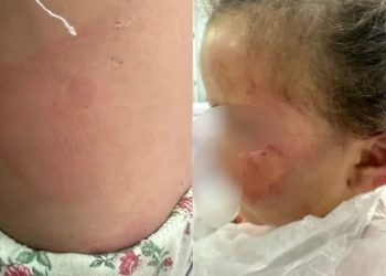 Mãe é presa suspeita de torturar filha de 3 anos até ela desmaiar, em Goiás