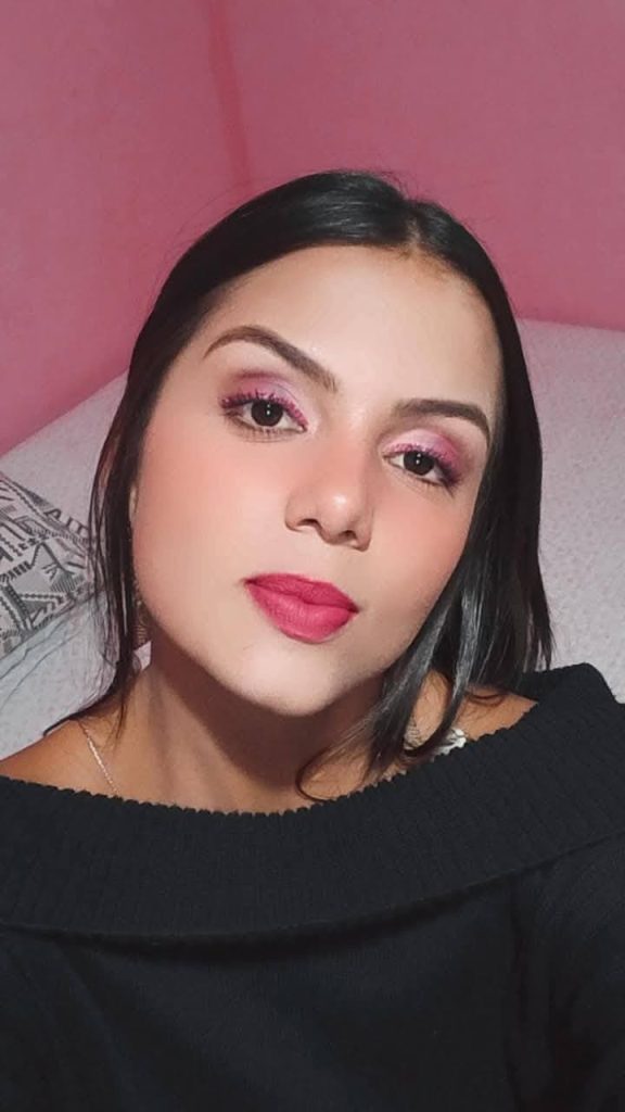 mulher atacada pelo próprio cachorro