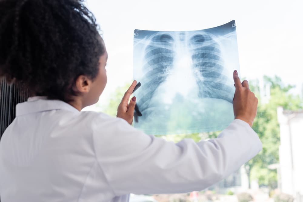 Radiografia do pulmão.