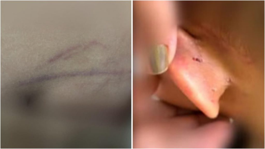 Pai é investigado por suspeita de espancar filho de 6 anos em Goiânia