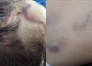 Criança de 2 anos morre com sinais de agressão em Aparecida; pai e babá são presos