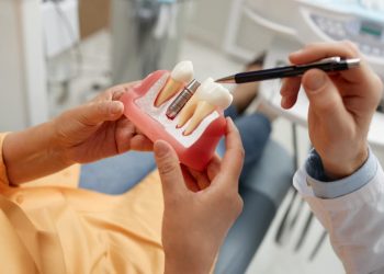 Implantes dentários: crescimento da procura acende debate sobre qualidade e acesso